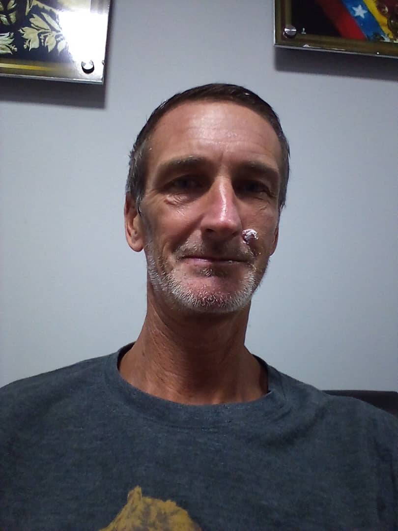 Infection on face